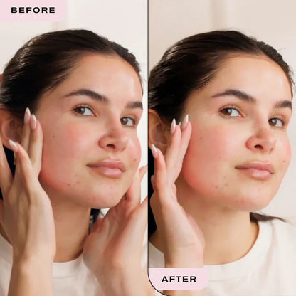 Erno Laszlo Vitality Treatment Mask The #1 At-Home, Spa Rescue Mask